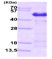 AR09196PU-L - Calumenin