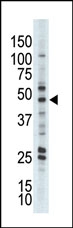AP13564PU-N - AKT2 / PKB beta