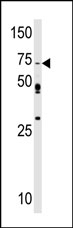 AP13577PU-N - SRPK1
