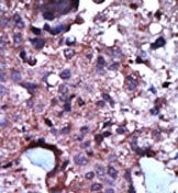 AP13593PU-N - PKLR
