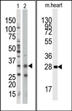 AP13597PU-N - AMPK beta-1 chain / AMPKb