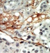 AP13598PU-N - AMPK beta-2 chain / PRKAB2