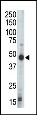 AP13604PU-N - PRKAR1B
