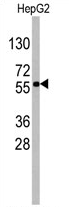 AP11363PU-N - SOX9