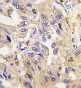 AP11372PU-N - Cadherin-6
