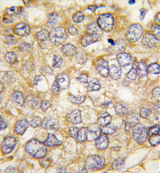AP11375PU-N - Chordin