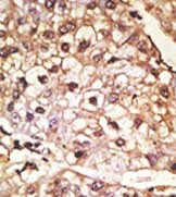 AP13472PU-N - Alpha-Synuclein / SNCA