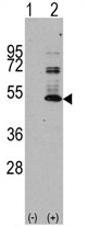 AP11390PU-N - MAPT / TAU