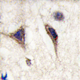 AP11390PU-N - MAPT / TAU