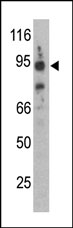 AP13492PU-N - Synphilin 1 / SNCAIP
