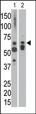AP13513PU-N - Myotubularin / MTM1