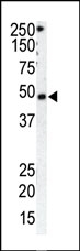 AP13526PU-N - Rhodopsin kinase
