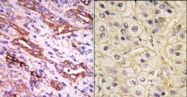 AP13526PU-N - Rhodopsin kinase