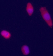 AP13408PU-N - Glypican-3 / GPC3