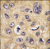 AP13420PU-N - Tuberin / TSC2
