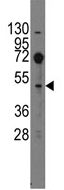 AP11393PU-N - EVX2