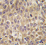 AP11397PU-N - Alpha-fetoprotein / AFP