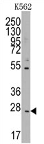 AP11413PU-N - CD8 beta