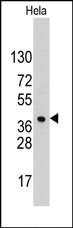 AP13464PU-N - HDGF