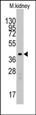 AP13465PU-N - TBRG1 / NIAM