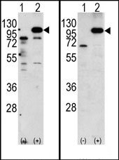 TA300060 - Amyloid beta A4 protein / APP