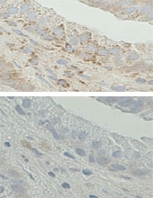 AP13329PU-N - HSD17B10 / ERAB