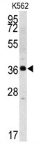 AP13358PU-N - KLK2 / Kallikrein-2