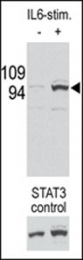AP12717PU-N - STAT3