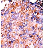 AP12717PU-N - STAT3