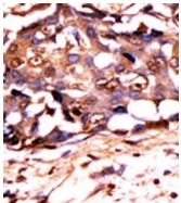 AP12718PU-N - STAT3