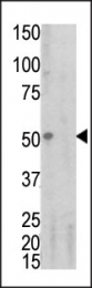 AP12726PU-N - CD120a / TNFR1