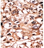 AP12726PU-N - CD120a / TNFR1