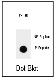 AP12733PU-N - TrkA