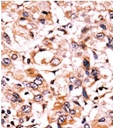 AP12735PU-N - WEE1 / Wee1-like protein kinase