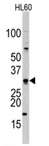 AP11424PU-N - CDCA8 / Borealin