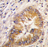 AP11424PU-N - CDCA8 / Borealin