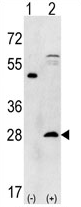 AP11427PU-N - PSMA5