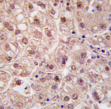 AP11427PU-N - PSMA5