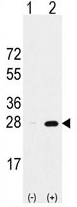 AP11429PU-N - PSMA5
