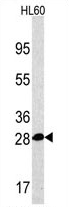 AP11429PU-N - PSMA5
