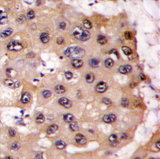 AP11429PU-N - PSMA5