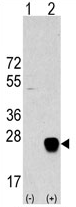 AP11438PU-N - METTL7A