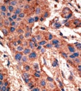 AP11855PU-N - CD292 / BMPR1A