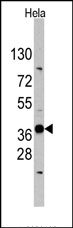 AP13273PU-N - Ectodysplasin-A