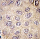 AP13273PU-N - Ectodysplasin-A