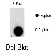AP12763PU-N - FGFR1