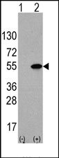 AP13291PU-N - ATF4