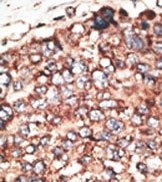 AP13174PU-N - MMP-17