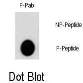 AP12788PU-N - AKT2 / PKB beta