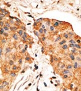 AP13195PU-N - Neuregulin 1